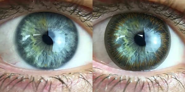 Czy trzeba iść do okulisty po soczewki kontaktowe? Odpowiedź, która zaskakuje