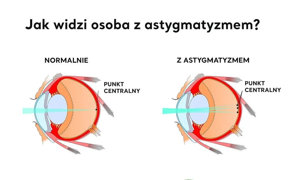 Cylindry w soczewkach: co to jest i jak wpływają na wzrok?