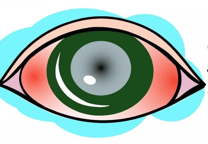 Jaskra czego nie wolno robić? Unikaj tych zagrożeń dla oczu