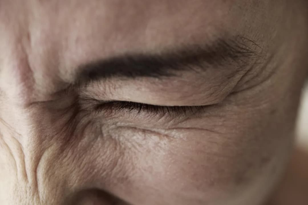 Zez pozorny – czym jest i jak go rozpoznać? Objawy i przyczyny